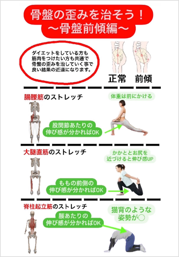骨盤前傾・後傾を解消する簡単ストレッチ | 田町芝浦・飯田橋のパーソナルトレーニングジムBiP